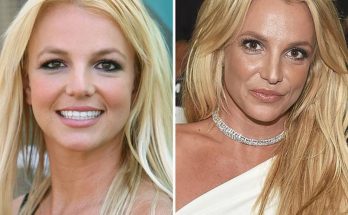 Britney Spears Nose Job