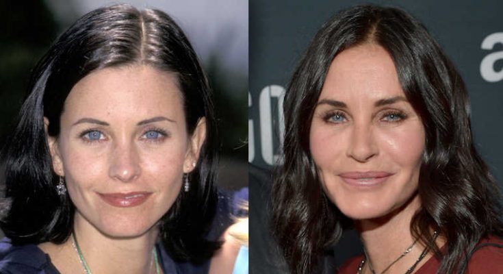 Courteney Cox Botox