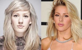 Ellie Goulding Nose Job