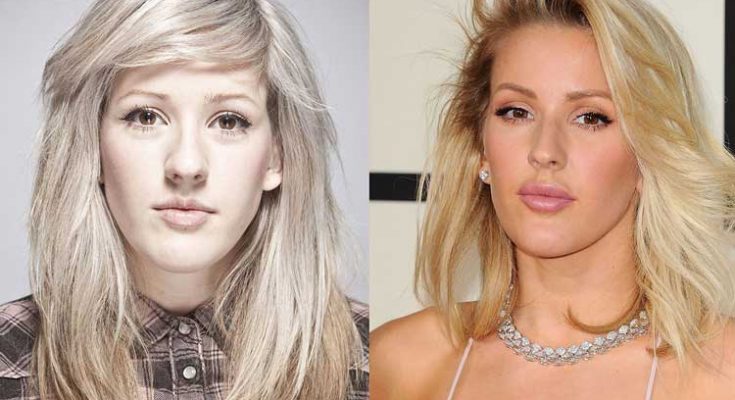 Ellie Goulding Nose Job