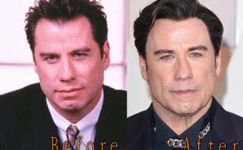 John Travolta Facelift Before After