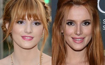 Bella Thorne Plastic Surgery