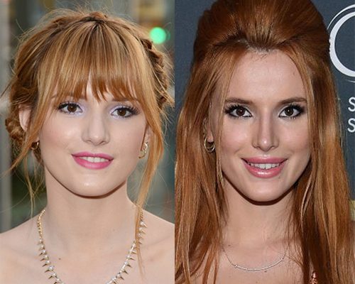 Bella Thorne Plastic Surgery