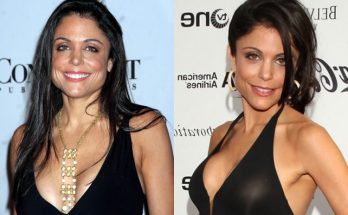 Bethenny Frankel Plastic Surgery