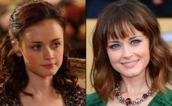 Alexis Bledel Plastic Surgery