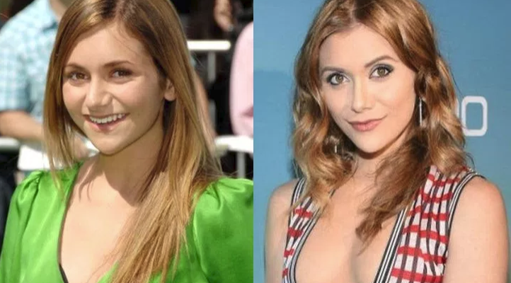 Alyson Stoner Nose Job