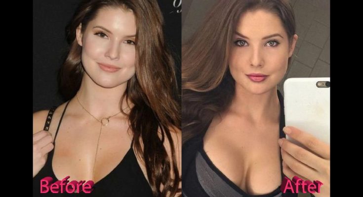 Amanda Cerny Boob Job