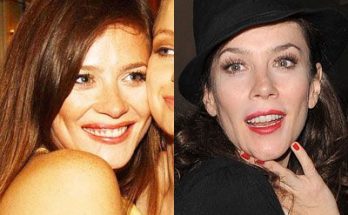 Anna Friel Plastic Surgery