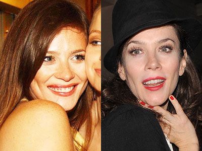 Anna Friel Plastic Surgery