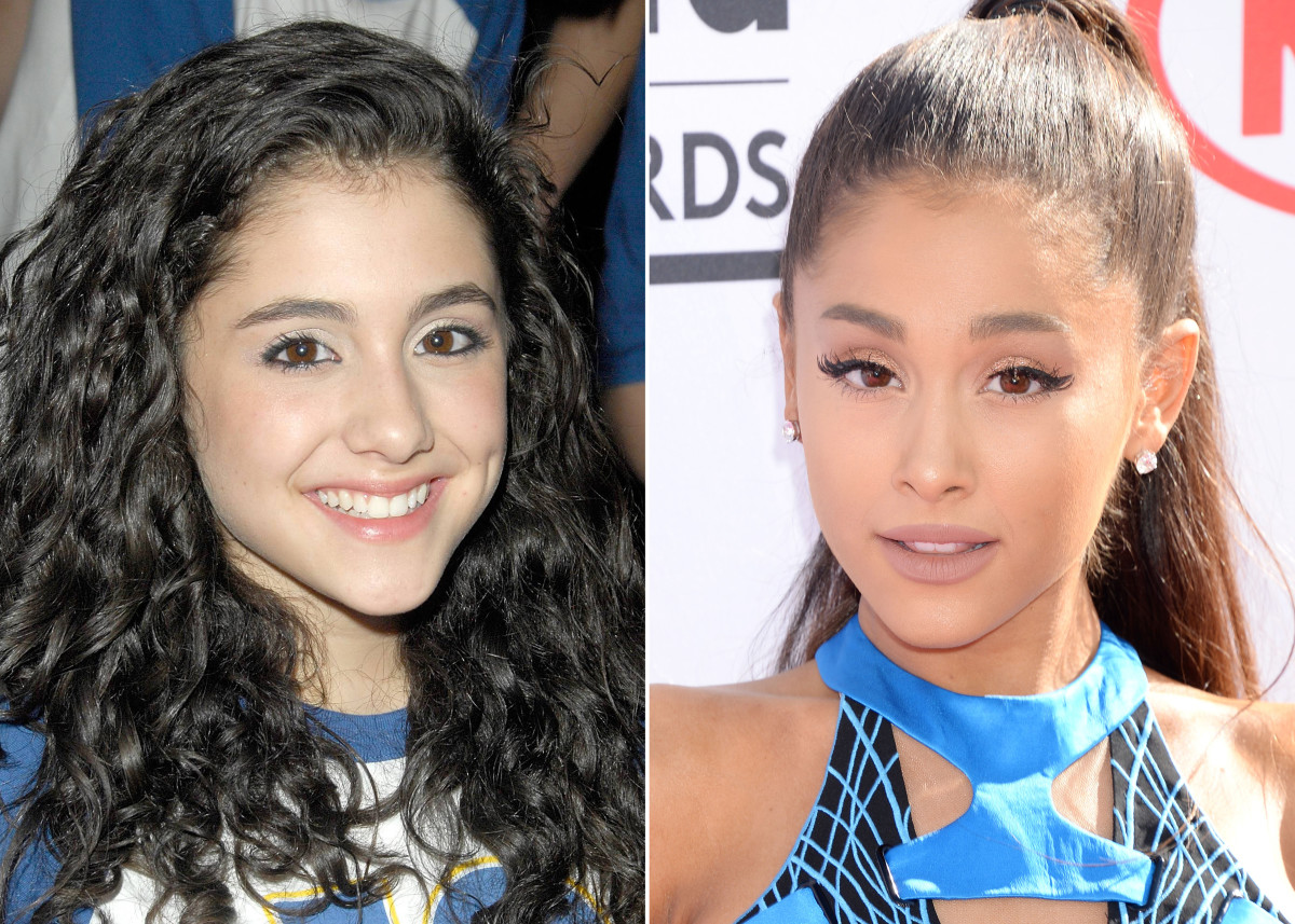 Ariana Grande Before And After Plastic Surgery Including Nose Job And
