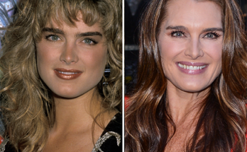 Brooke Shields Nose Job