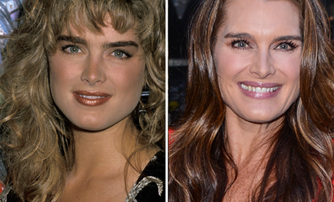 Brooke Shields Nose Job