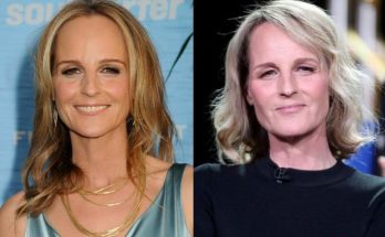 Helen Hunt Facelift