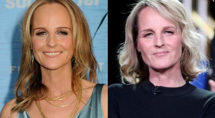 Helen Hunt Facelift