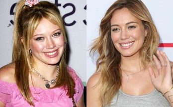 Hillary Duff Plastic Surgery