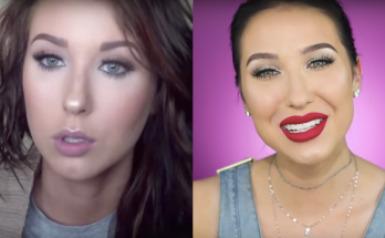 Jaclyn Hill Botox