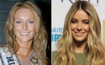 Jennifer Hawkins Nose Job Rumors