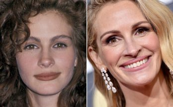 Julia Roberts Plastic Surgery Rumors