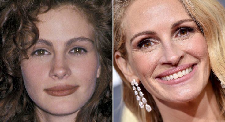 Julia Roberts Plastic Surgery Rumors