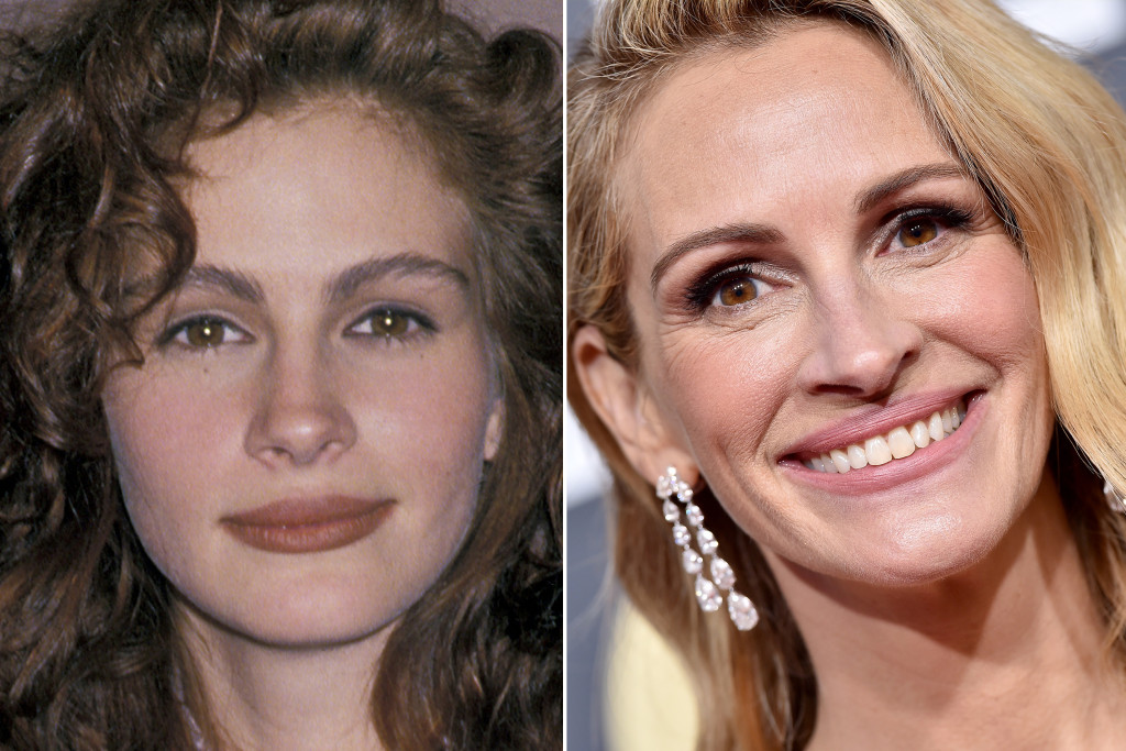 Julia Roberts Before And After