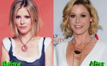 Julie Bowen Plastic Surgery Rumors