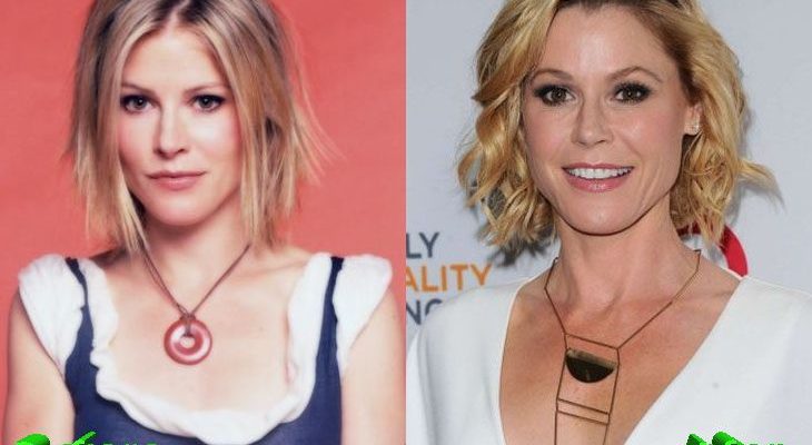 Julie Bowen Plastic Surgery Rumors