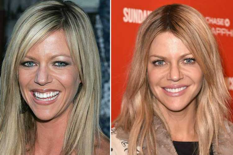 Did Kaitlin Olson Undergo Plastic Surgery Including Boob Job and Nose Job? 