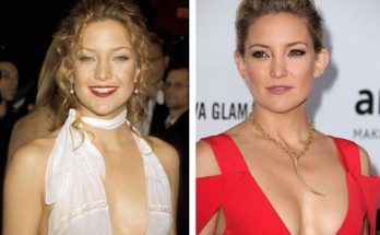 Kate Hudson Boob Job