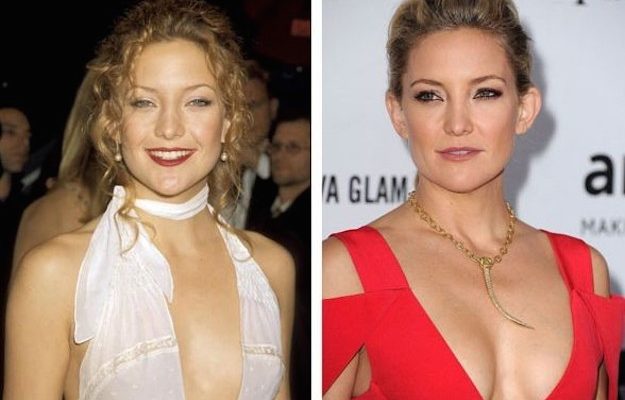 Kate Hudson Boob Job