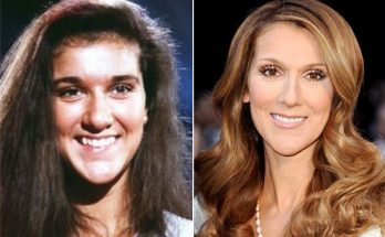 Celine Dion Nose Job