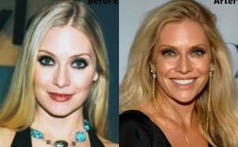 Emily Procter Plastic Surgery