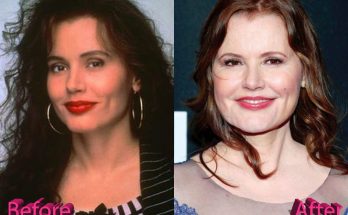 Geena Davis Botox