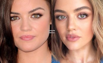 Lucy Hale Nose Job