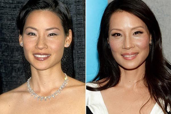 Lucy Liu Nose Job