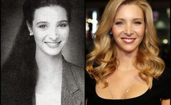 Lisa Kudrow Nose Job Plastic Surgery