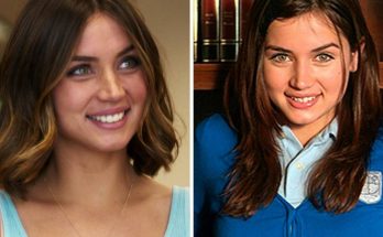 Ana de Armas Plastic Surgery Nose Job Boob Job Botox Lips