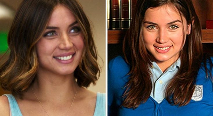 Ana de Armas Plastic Surgery Nose Job Boob Job Botox Lips