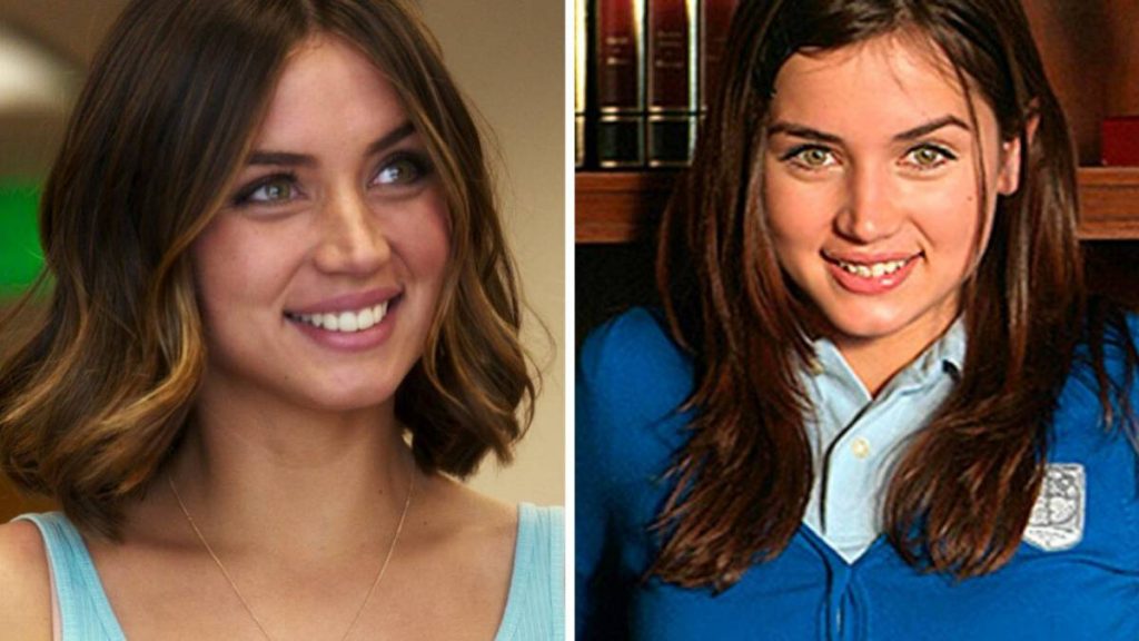 Did Ana de Armas Undergo Plastic Surgery Including Boob Job, Nose Job, Boto...