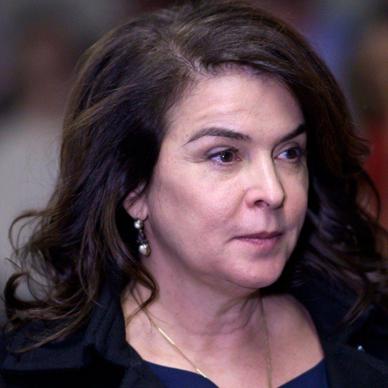 Annabella Sciorra Botox Plastic Surgery