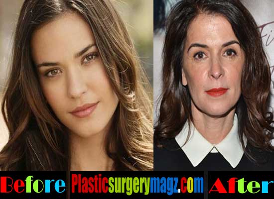 Annabella Sciorra Nose Job Plastic Surgery