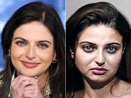 Bianna Golodryga Botox Plastic Surgery