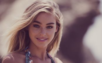 Elizabeth Turner Plastic Surgery Nose Job Boob Job Botox Lips