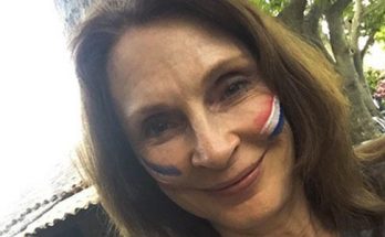 Gates McFadden Plastic Surgery Nose Job Boob Job Botox Lips