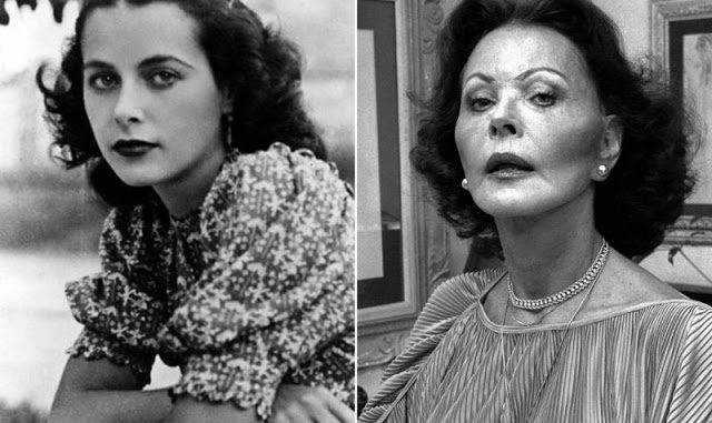 Hedy Lamarr Nose Job Plastic Surgery