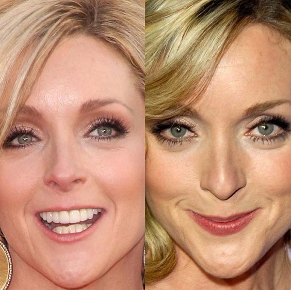 Jane Krakowski Lips Plastic Surgery