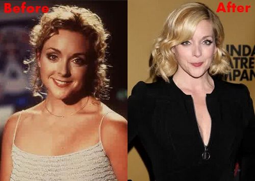 Jane Krakowski Nose Job Plastic Surgery