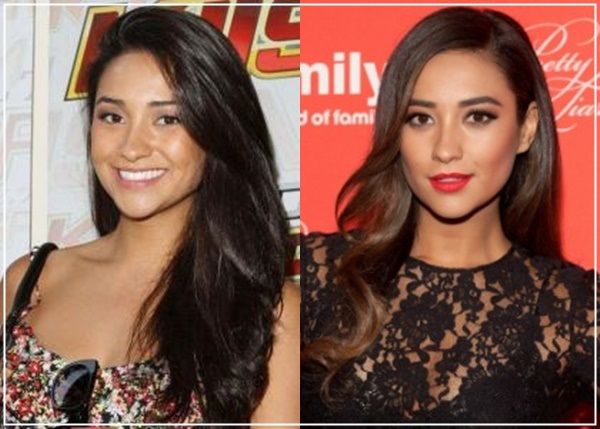 Julia Benson Nose Job Plastic Surgery