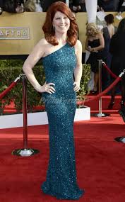 Kate Flannery Boob Job Plastic Surgery