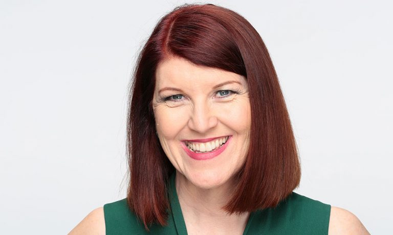 Kate Flannery Lips Plastic Surgery