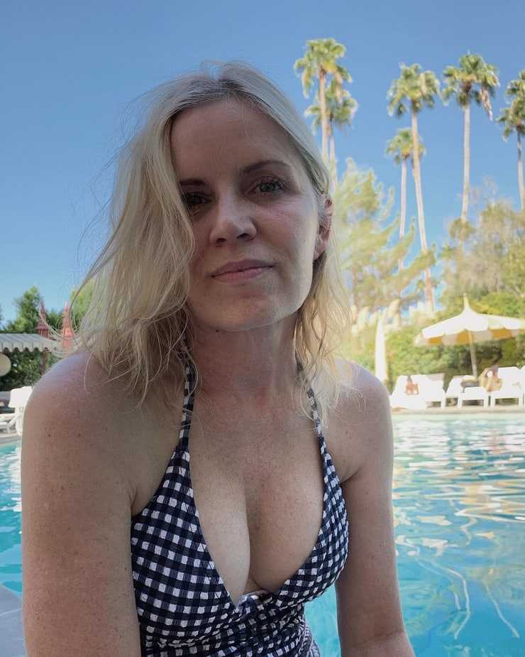 Kim Dickens Boob Job Plastic Surgery